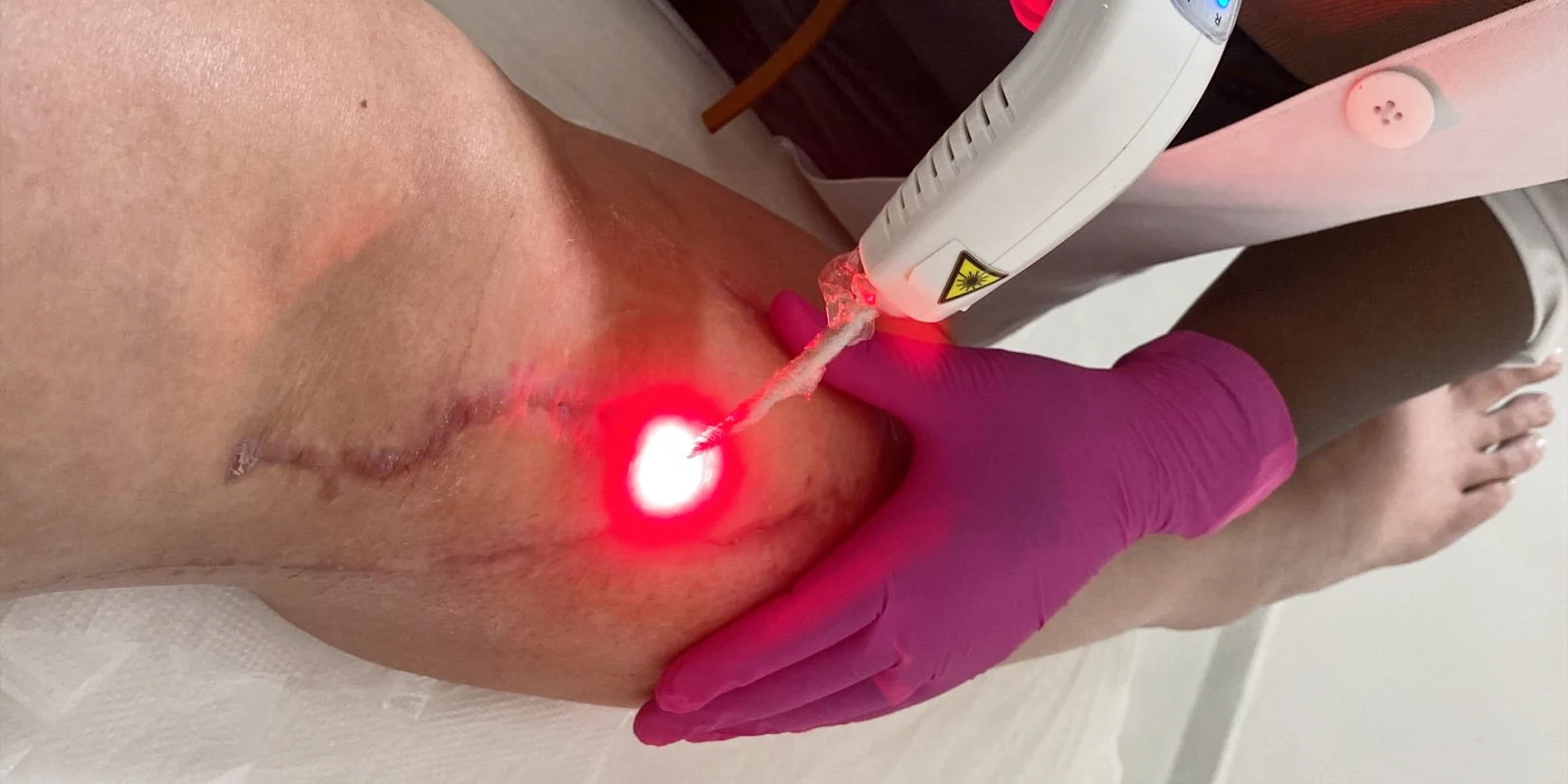 Laserterapia